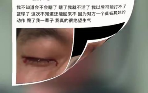 jinnianhui金年会眼科专家谈郭艾伦：结膜受伤经处理大概率恢复得不错 不要太忧心